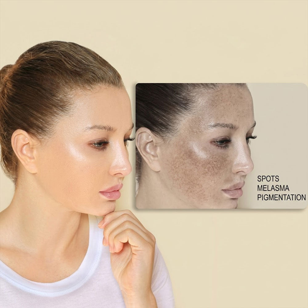 Brightening & Pigmentation