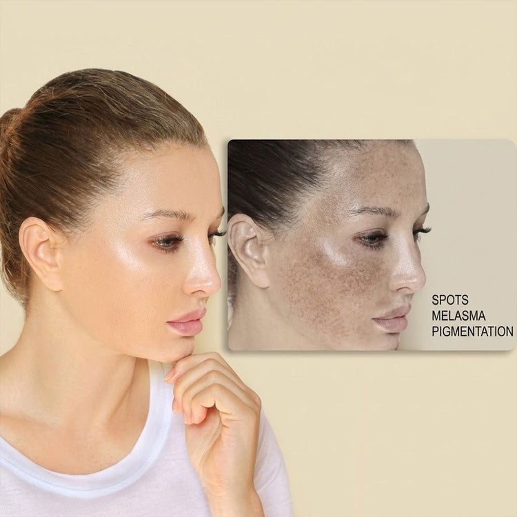 Brightening & Pigmentation