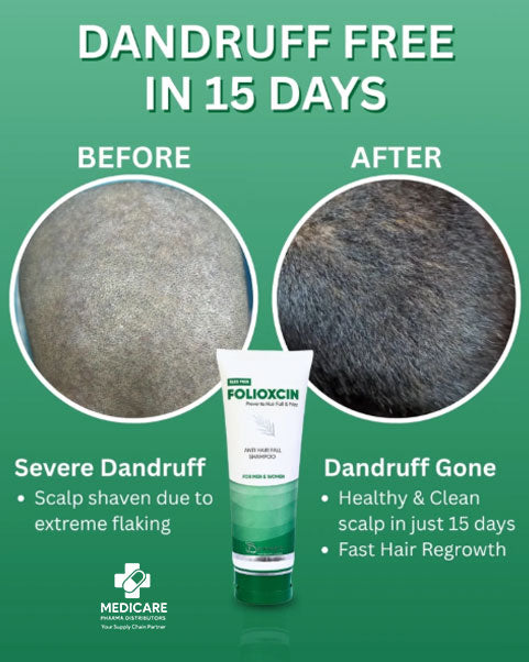 Folioxcin Anti Hair Fall Shampoo