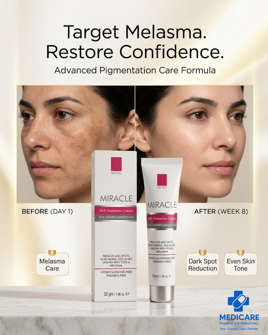 Miracle Anti Melasma Cream