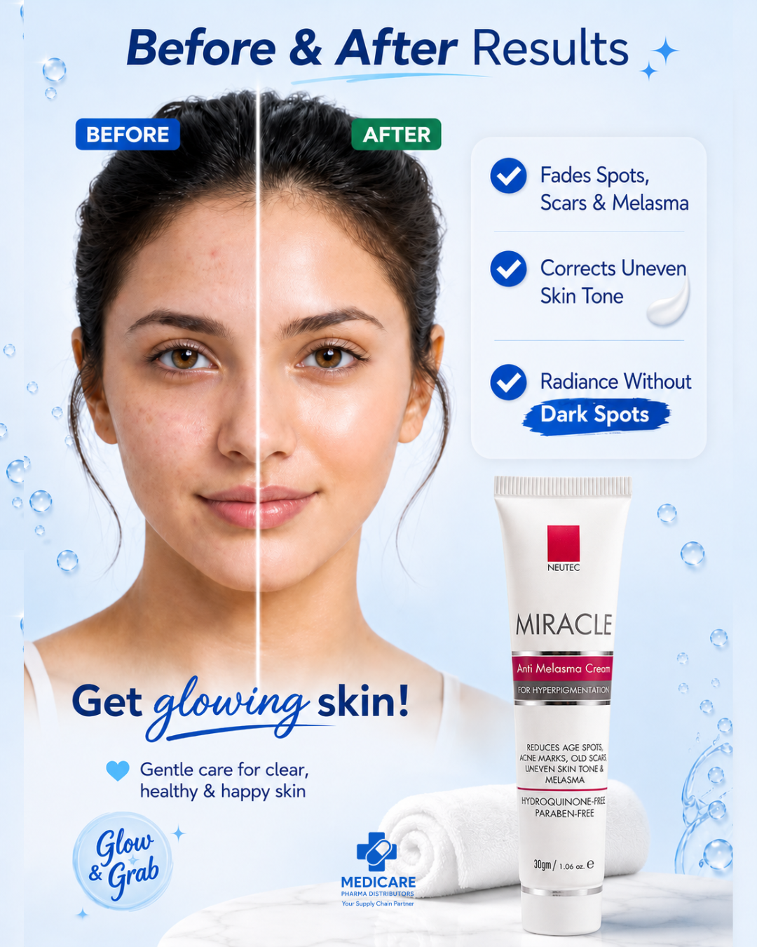Miracle Anti Melasma Cream